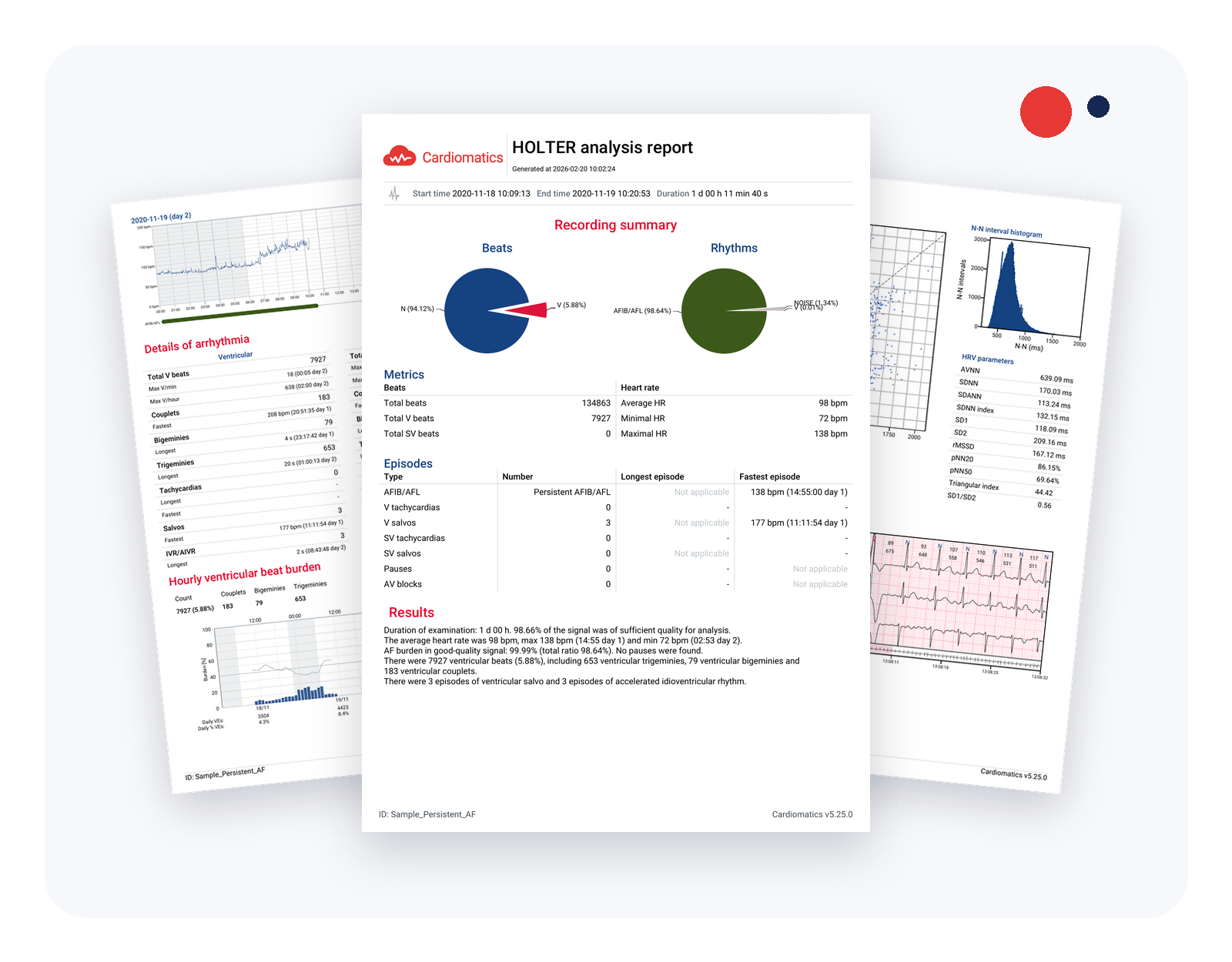Cardiomatics_sample_report_graphic